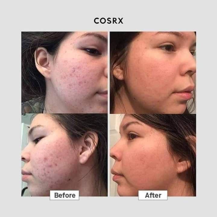 Cosrx Advanced Snail 96 Mucin power Essence